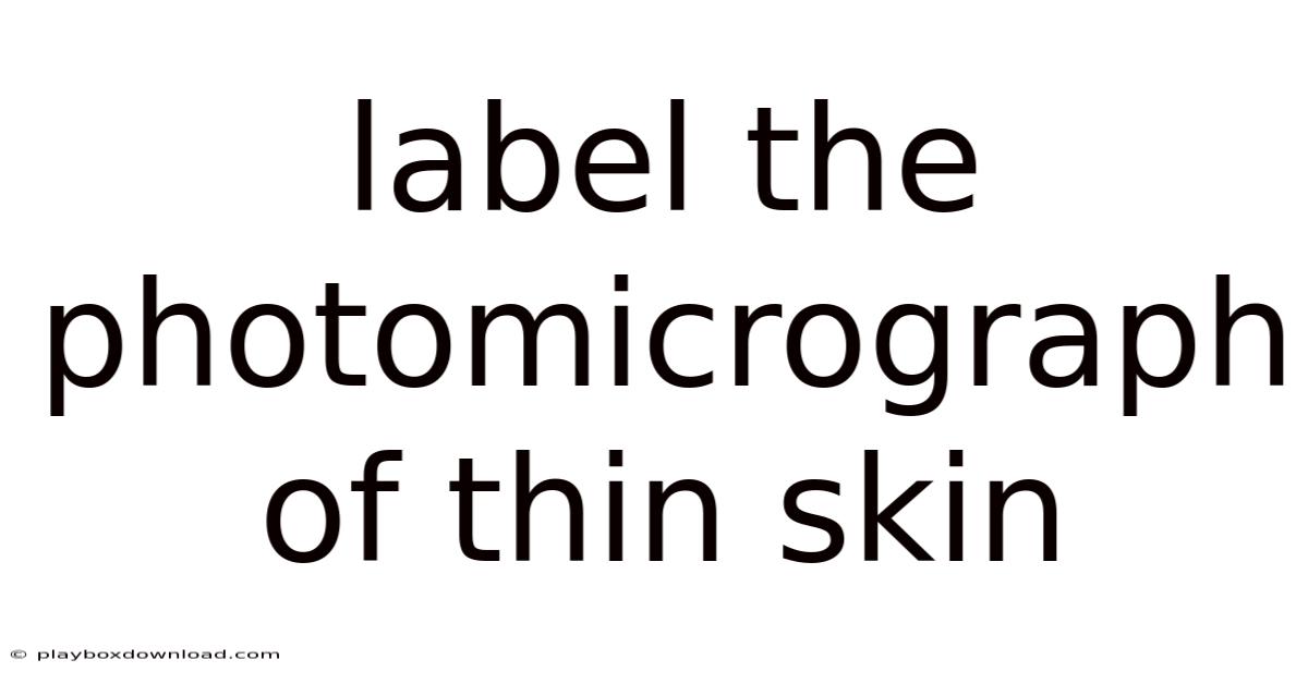 Label The Photomicrograph Of Thin Skin